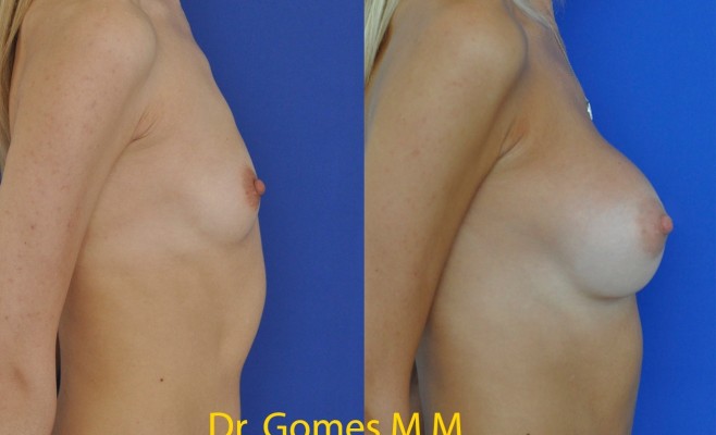 профиль увел 4 мес c подписью