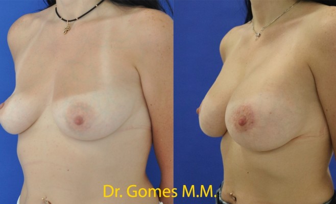 (увел+пер под 5 мес)3-4 c надписью