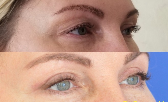 верх блеф 2 п_о (3-4)